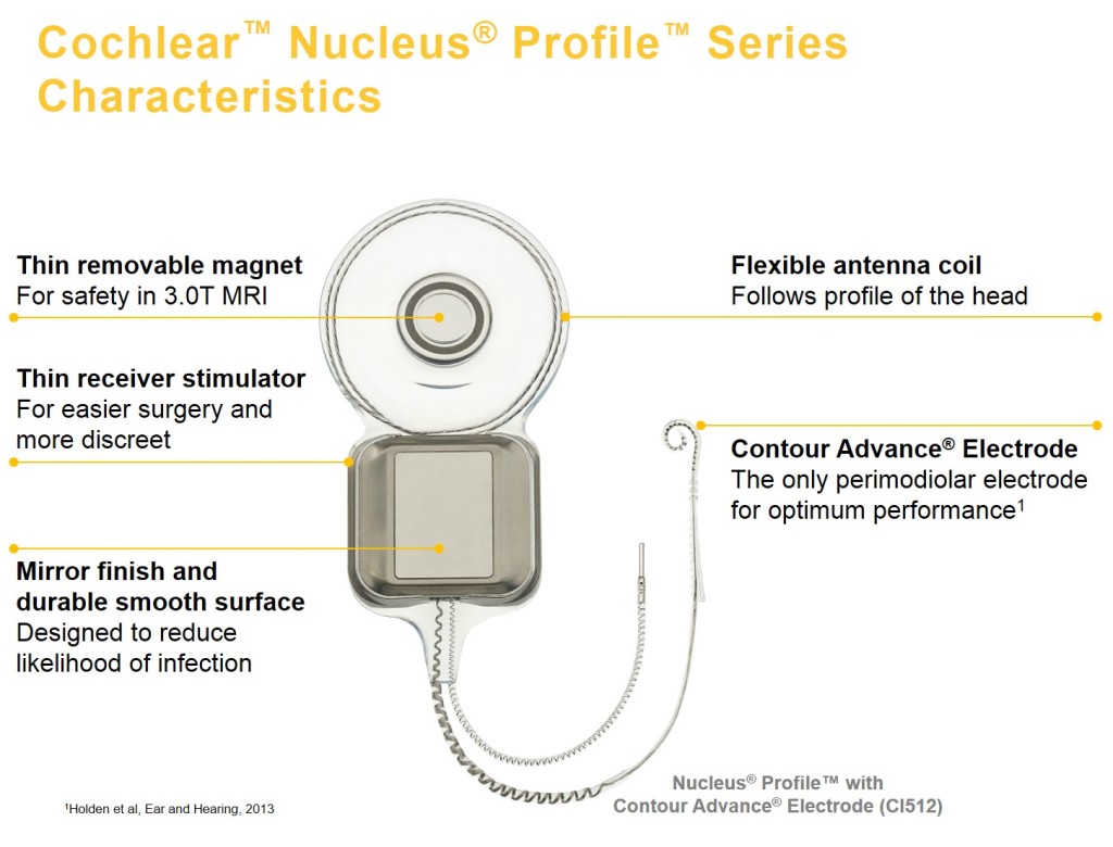 Cochlear Nucleus Profile hallásjavító implantátum